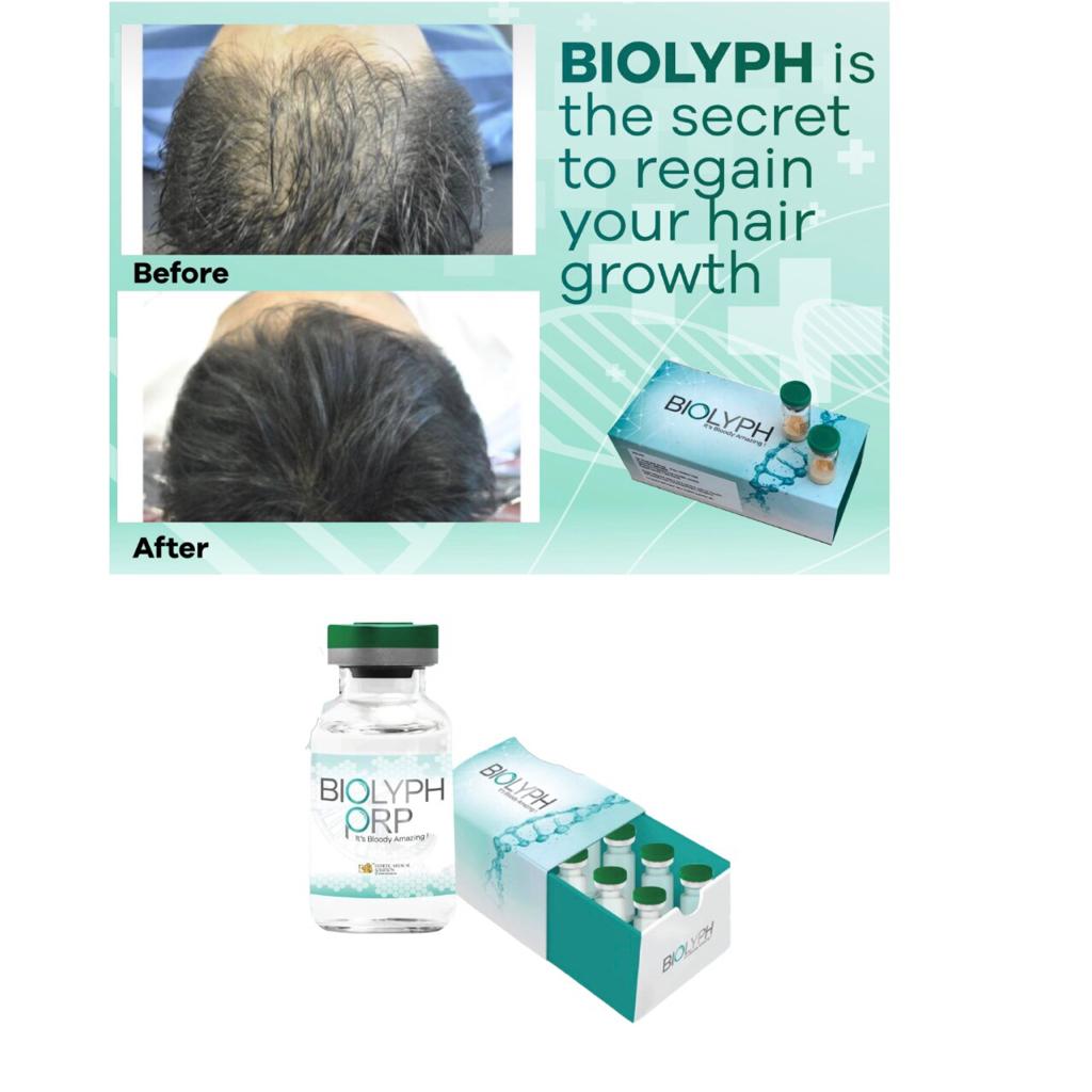 Biolyph PRP