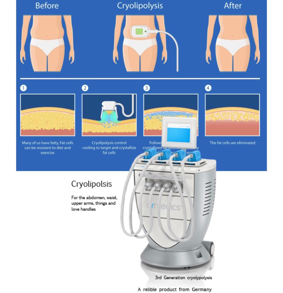 Bio-identical Hormone Replacement Therapy (BHRT)