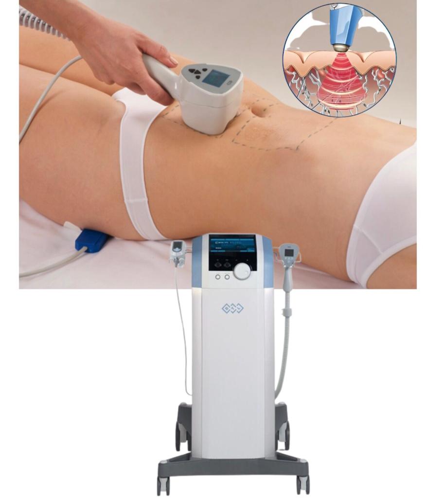 Dermal fillers