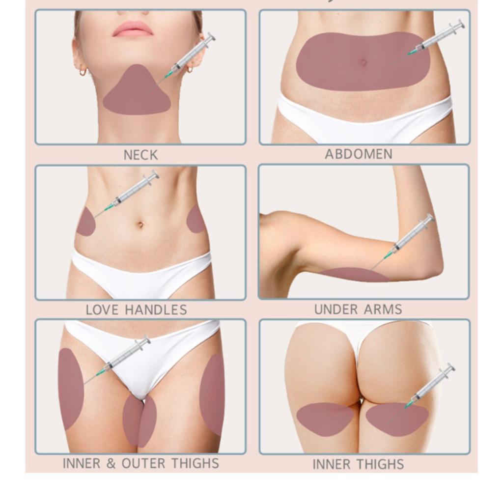 Mesolipolysis