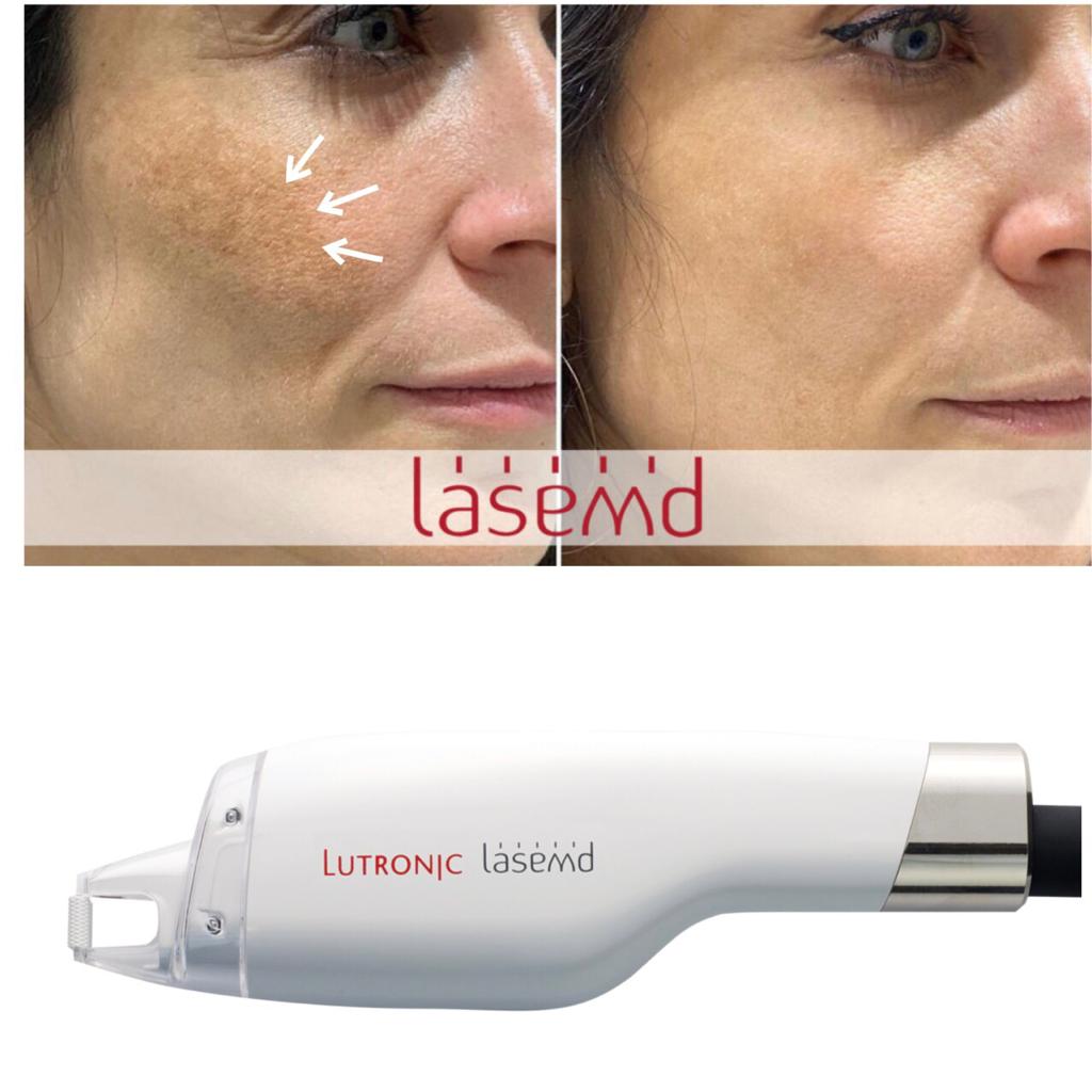 LaseMD