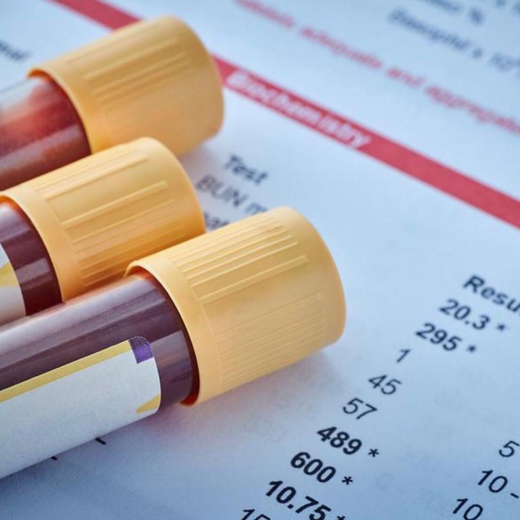 Anti-aging blood test